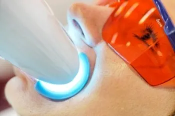 albirea cu laser - costuri, daune reale, înainte și după fotografii