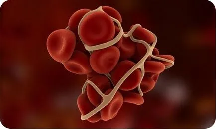 Hemofilie Tratamentul - portalul medical EUROLAB