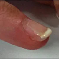 serviciu de unghii