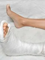 fractura deschisă picior