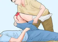 fractura deschisă picior