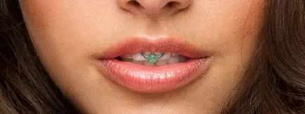 Piercing Smiley - fotografii, durere, consecinte, riscuri, pret