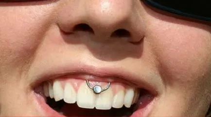 Piercing Smiley - fotografii, durere, consecinte, riscuri, pret