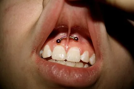 Piercing Smiley - fotografii, durere, consecinte, riscuri, pret