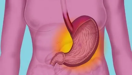 Simptomele de semne de reflux acid și simptome ale bolii