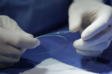 Stenting - ceea ce este costa stenting nave ale inimii