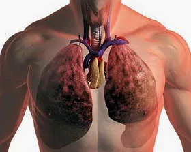 Lung Procedura de ultrasunete pentru numirea, conduita, diagnosticul de cancer, in special