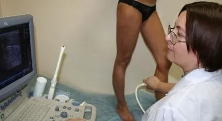 navele Uzi și venele picioarelor, care pot fi făcute la Moscova și care este prețul (mai mic) navele Uzi și venele picioarelor, care se poate face în Moscova și ce preț