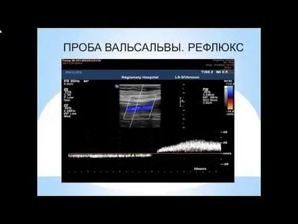 navele Uzi și venele picioarelor, care pot fi făcute la Moscova și care este prețul (desigur) navele Uzi și venele picioarelor, care se poate face în Moscova și ce preț