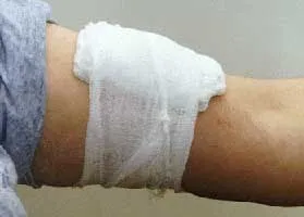 Tipuri de sângerare, de prim ajutor, cum să se oprească și semne