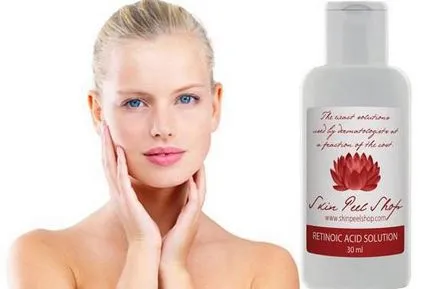 coaja galben - ceea ce este recenzii, cosmeticieni și clienții cu privire la procedura de (a) coaja galben - ceea ce este recenzii, cosmeticieni și clienții despre procedura