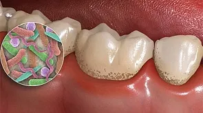 Dentistul - stomatolog difera de la dentist - portalul dentar (stomatolog) Dentist - difera de la dentist dentist - portal stomatologic