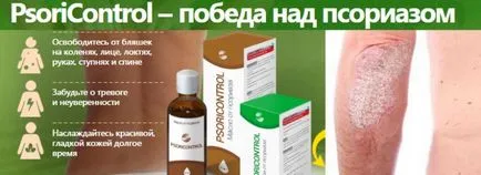 Psoriazisul nu poate mânca Psoriazisul nu poate mânca