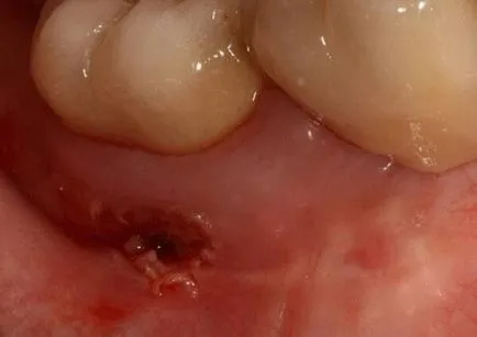 Fluxul cura la domiciliu Fluxul cura la domiciliu