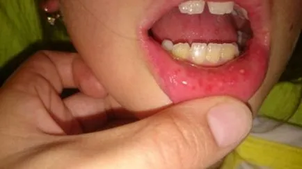 gâtul copilului de a face roșu
