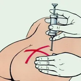 Ca preparate injectabile administrate