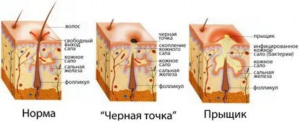 Eliminare puncte negre acasă nas