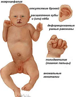 dimensiunea parietal coccisului de ea