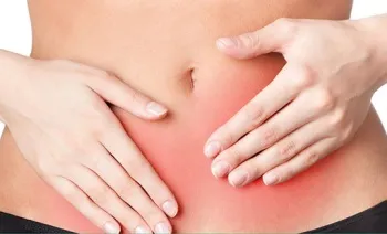 Endometrioza tratamente populare Endometrioza tratamente populare