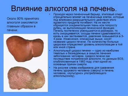Cum de a trata ficat după consumul de alcool