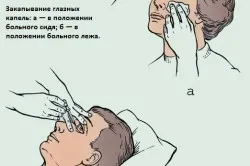 Anesthetize ochiul Anesthetize ochiul