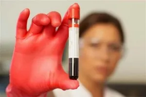 Acest lucru nu poate fi consumat înainte de test de sânge Acest lucru nu poate fi consumat înainte de test de sânge