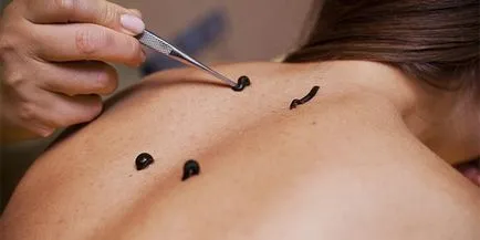 Acest lucru scade pastile tensiunii arteriale