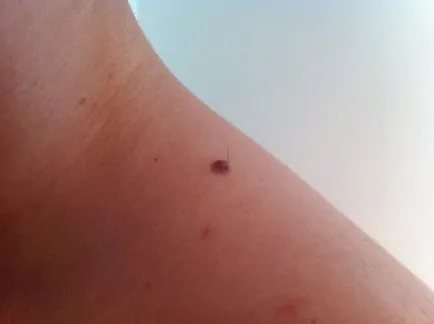 De ce moli salt De ce moli salt
