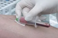 Ce este un anticorp cu virusul