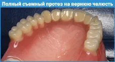 Fabricația proteze totale