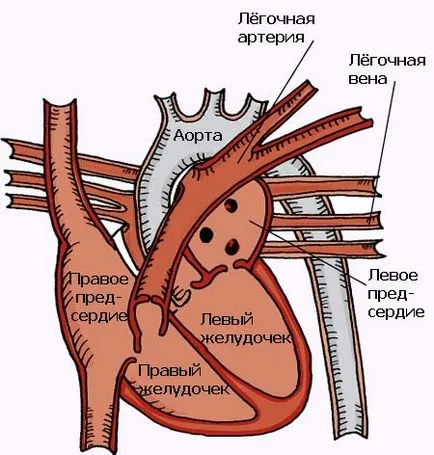 Cum de a găsi inima la Cum de a găsi inima la