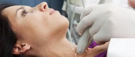 vasculare ce vasculare ce
