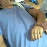 Cum de a reduce un umăr