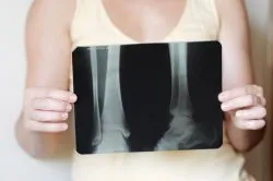 Ce se poate face în cazul în care ligamentele luxat Ce se poate face în cazul în care ligamentele luxat