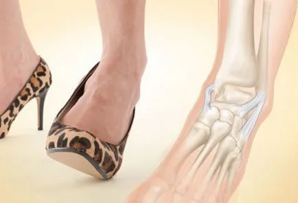Ce se poate face în cazul în care ligamentele luxat