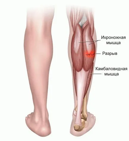 Ce se poate face în cazul în care ligamentele luxat