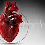 Dieta dupa infarct miocardic Dieta dupa infarct miocardic