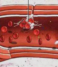 Hemostaza este ceea ce este Hemostaza este ceea ce este