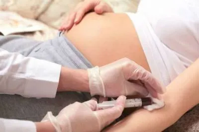 Hemostaza este ceea ce este Hemostaza este ceea ce este