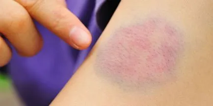 Hemostaza este ceea ce este