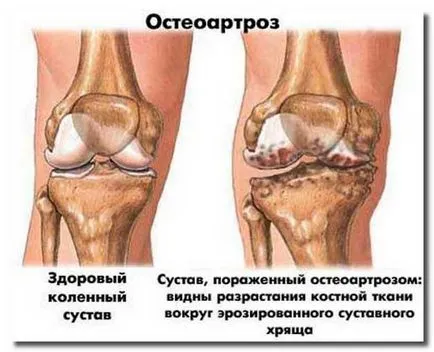 Ce ibuprofenul medicamente Ce ibuprofenul medicamente