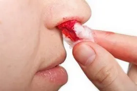 Cum de a face acest lucru ar sângereze Cum de a face acest lucru ar sângereze