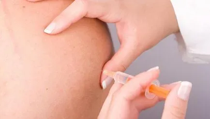 Cum de a se pune în injecțiile fesa