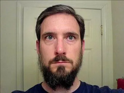 Scoaterea barba Scoaterea barba