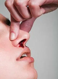 Cum de a face acest lucru ar sângereze