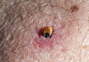 Cum se extrage capusa Cum se extrage capusa