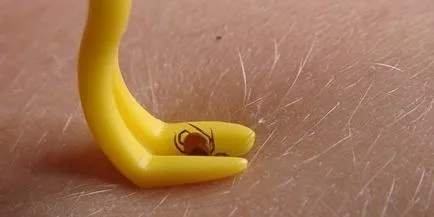 Cum se extrage capusa Cum se extrage capusa