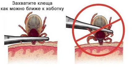 Cum se extrage capusa Cum se extrage capusa