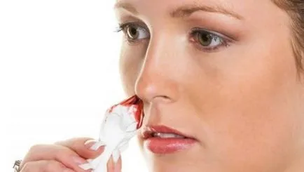 Cum de a face acest lucru ar sângereze Cum de a face acest lucru ar sângereze