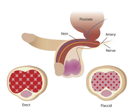 Simptomele prostatita la bărbați